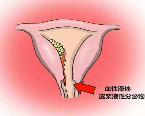 广州找女人代孕电话,广州两公司违法宣传海外代孕生子被查_去哪找人代怀
