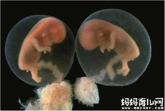 能做供卵试管么_供卵孩子DNA_引起葡萄胎的原因都有啥不提前了解你就等着后悔